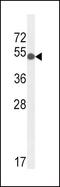 Glucose-6-Phosphate Isomerase antibody, PA5-26787, Invitrogen Antibodies, Western Blot image 