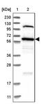 Target Of Myb1 Like 2 Membrane Trafficking Protein antibody, PA5-54604, Invitrogen Antibodies, Western Blot image 