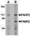 Mitogen-Activated Protein Kinase Kinase Kinase 7 antibody, orb7046, Biorbyt, Western Blot image 