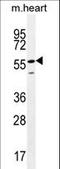 Smoothelin Like 2 antibody, LS-C161329, Lifespan Biosciences, Western Blot image 