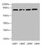 TBC1 Domain Family Member 14 antibody, CSB-PA889187LA01HU, Cusabio, Western Blot image 