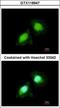 Aminoacyl TRNA Synthetase Complex Interacting Multifunctional Protein 2 antibody, GTX118947, GeneTex, Immunocytochemistry image 