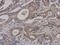 Non-SMC Condensin I Complex Subunit H antibody, GTX107344, GeneTex, Immunohistochemistry paraffin image 