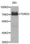 Tudor Domain Containing 3 antibody, abx004610, Abbexa, Western Blot image 