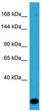 Zinc Finger CCCH-Type Containing 13 antibody, TA331968, Origene, Western Blot image 