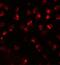 Calcium-transporting ATPase type 2C member 2 antibody, GTX32009, GeneTex, Immunofluorescence image 