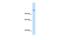 Carbamoyl-Phosphate Synthase 1 antibody, GTX46535, GeneTex, Western Blot image 