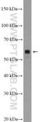 Leucine Rich Repeat Transmembrane Neuronal 2 antibody, 23094-1-AP, Proteintech Group, Western Blot image 