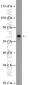 Leucine-rich repeat transmembrane neuronal protein 2 antibody, 23094-1-AP, Proteintech Group, Western Blot image 