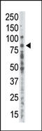 Protein Kinase C Alpha antibody, 62-590, ProSci, Western Blot image 