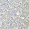 Alanyl-TRNA Synthetase 2, Mitochondrial antibody, 23-211, ProSci, Immunohistochemistry paraffin image 