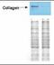 Collagen Type I Alpha 2 Chain antibody, ab34710, Abcam, Western Blot image 