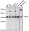 Protein N-terminal asparagine amidohydrolase antibody, A15562, ABclonal Technology, Western Blot image 