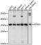 N-Terminal Asparagine Amidase antibody, A15562, ABclonal Technology, Western Blot image 