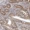 Outer Dense Fiber Of Sperm Tails 2 Like antibody, HPA028095, Atlas Antibodies, Immunohistochemistry paraffin image 