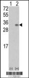 Vascular Endothelial Growth Factor B antibody, 62-228, ProSci, Western Blot image 