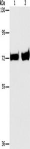 Phosphoenolpyruvate Carboxykinase 1 antibody, TA350924, Origene, Western Blot image 