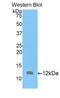 Actin Related Protein 2/3 Complex Subunit 4 antibody, LS-C292606, Lifespan Biosciences, Western Blot image 