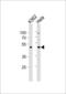 Actin Like 6A antibody, LS-C344496, Lifespan Biosciences, Western Blot image 