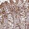 NAD Synthetase 1 antibody, PA5-65214, Invitrogen Antibodies, Immunohistochemistry frozen image 