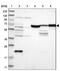 Junctophilin 1 antibody, NBP1-83076, Novus Biologicals, Western Blot image 