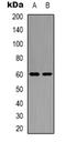 Growth Factor Receptor Bound Protein 10 antibody, orb338988, Biorbyt, Western Blot image 