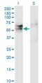 TSPY Like 1 antibody, MA5-20160, Invitrogen Antibodies, Western Blot image 