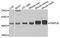 Peptidase, Mitochondrial Processing Beta Subunit antibody, A4312, ABclonal Technology, Western Blot image 