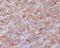 Paxillin antibody, M01033, Boster Biological Technology, Immunohistochemistry paraffin image 