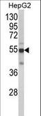 Cytochrome P450 Family 2 Subfamily J Member 2 antibody, LS-C167228, Lifespan Biosciences, Western Blot image 
