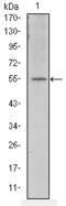 Activating Transcription Factor 2 antibody, M00916-1, Boster Biological Technology, Western Blot image 