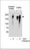 ERBB2 antibody, TA324788, Origene, Western Blot image 