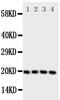 Lipocalin 1 antibody, PA5-79588, Invitrogen Antibodies, Western Blot image 