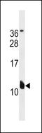 Potassium Voltage-Gated Channel Subfamily E Regulatory Subunit 2 antibody, 60-422, ProSci, Western Blot image 