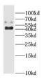 Cytochrome P450 Family 20 Subfamily A Member 1 antibody, FNab02150, FineTest, Western Blot image 