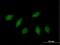 H2.0 Like Homeobox antibody, H00003142-B01P, Novus Biologicals, Immunofluorescence image 