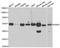 Aspartyl-TRNA Synthetase antibody, A06519, Boster Biological Technology, Western Blot image 