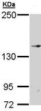 Transient Receptor Potential Cation Channel Subfamily M Member 2 antibody, ab96785, Abcam, Western Blot image 