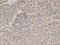 Hydroxyacyl-CoA Dehydrogenase Trifunctional Multienzyme Complex Subunit Alpha antibody, A03666, Boster Biological Technology, Immunohistochemistry paraffin image 