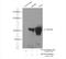 Eukaryotic Elongation Factor 2 Kinase antibody, 13510-1-AP, Proteintech Group, Immunoprecipitation image 