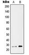 RAB26, Member RAS Oncogene Family antibody, LS-C353373, Lifespan Biosciences, Western Blot image 