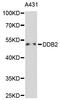 Damage Specific DNA Binding Protein 2 antibody, MBS127461, MyBioSource, Western Blot image 