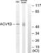 Activin A Receptor Type 1B antibody, LS-C118878, Lifespan Biosciences, Western Blot image 