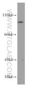 Glycogen Phosphorylase B antibody, 55380-1-AP, Proteintech Group, Western Blot image 