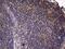 Interleukin 1 Receptor Antagonist antibody, NBP2-45408, Novus Biologicals, Immunohistochemistry paraffin image 