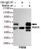 IKAROS Family Zinc Finger 1 antibody, STJ99100, St John