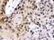 Transcription Factor 7 Like 1 antibody, PB9897, Boster Biological Technology, Immunohistochemistry paraffin image 