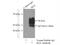 BLK Proto-Oncogene, Src Family Tyrosine Kinase antibody, 10510-1-AP, Proteintech Group, Immunoprecipitation image 