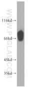 Solute Carrier Family 27 Member 3 antibody, 12943-1-AP, Proteintech Group, Western Blot image 