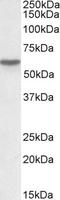 GC Vitamin D Binding Protein antibody, EB08019, Everest Biotech, Western Blot image 